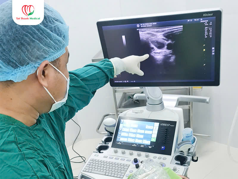 Siêu âm để chẩn đoán u giáp