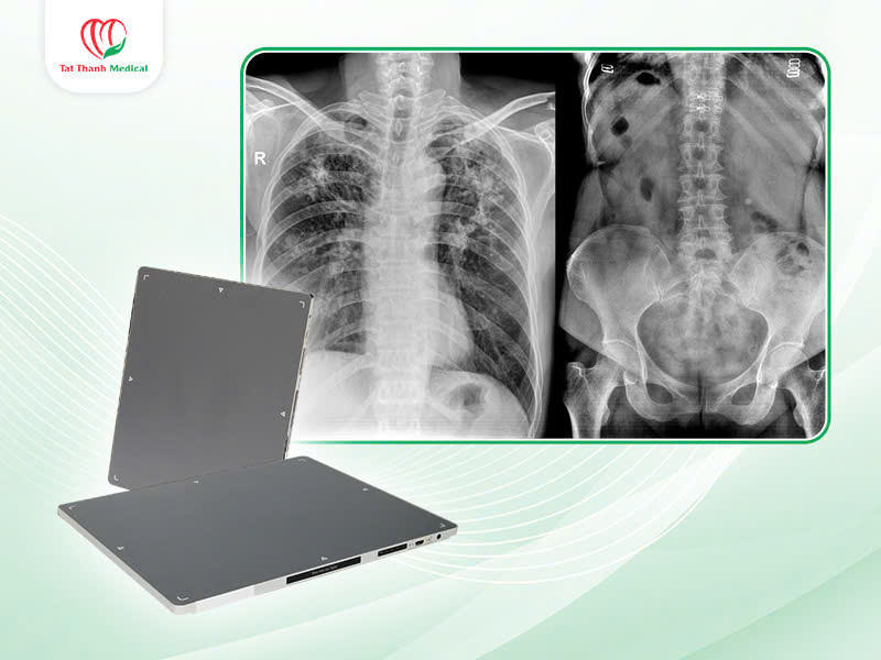 Tấm nhận ảnh X-quang KTS DR