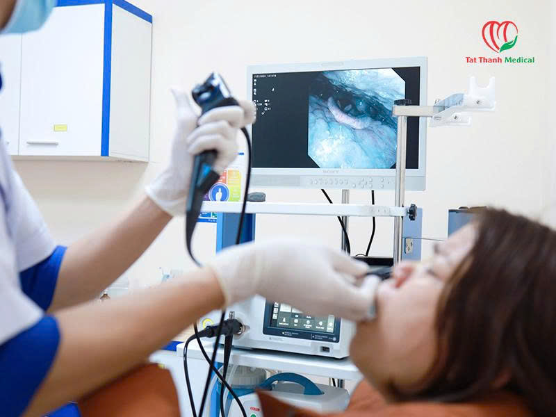 Giá hệ thống nội soi tiêu hóa