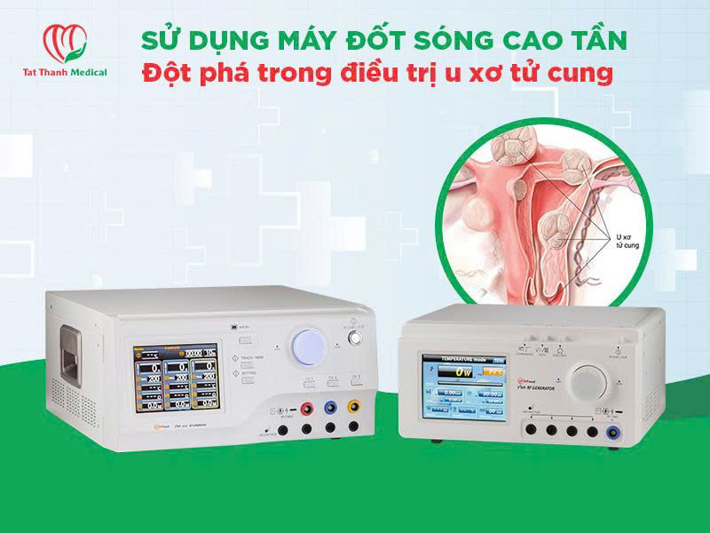 máy đốt sóng cao tần điều trị u xơ tử cung