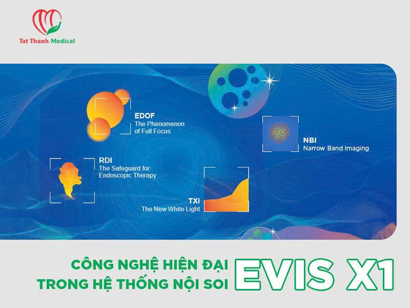 công nghệ Olympus evis x1