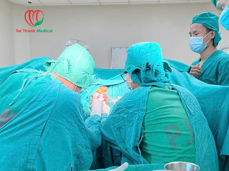 điều trị trĩ bằng sóng cao tần