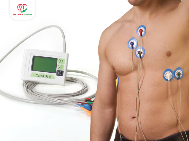 Ứng dụng của máy Holter điện tim trong chẩn đoán rối loạn nhịp tim