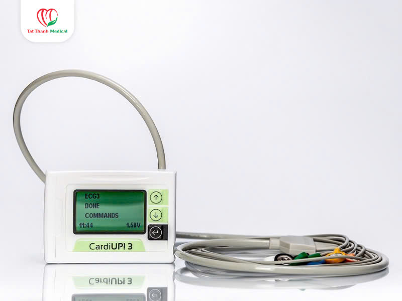 Ứng dụng của máy Holter điện tim trong chẩn đoán rối loạn nhịp tim