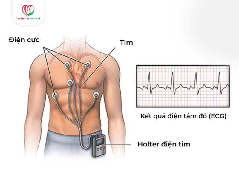 máy Holter điện tim Meditech CardiUP!3