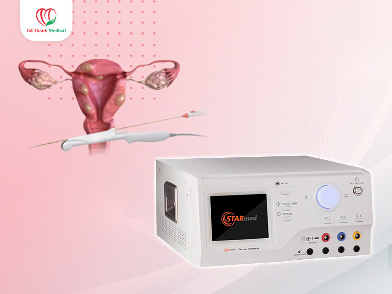 Máy đốt sóng cao tần STARmed điều trị u xơ tử cung