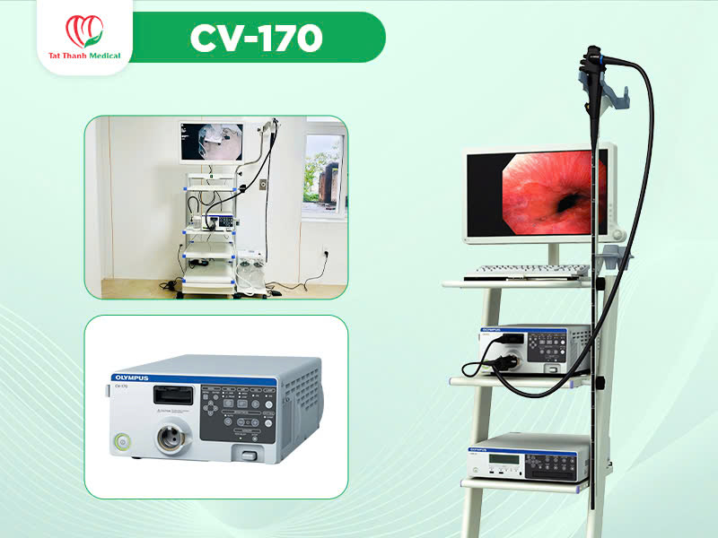 Hệ thống nội soi tiêu hóa Olympus - Giải pháp toàn diện nâng tầm chẩn đoán & điều trị