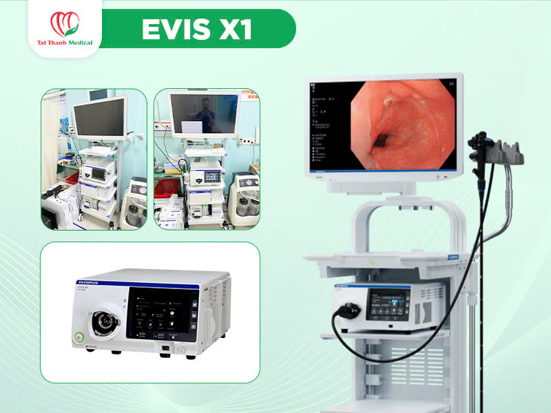 Hệ thống nội soi tiêu hóa Olympus - Giải pháp toàn diện nâng tầm chẩn đoán & điều trị