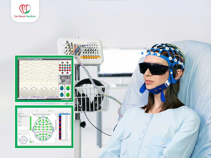 máy điện não trong bệnh viện