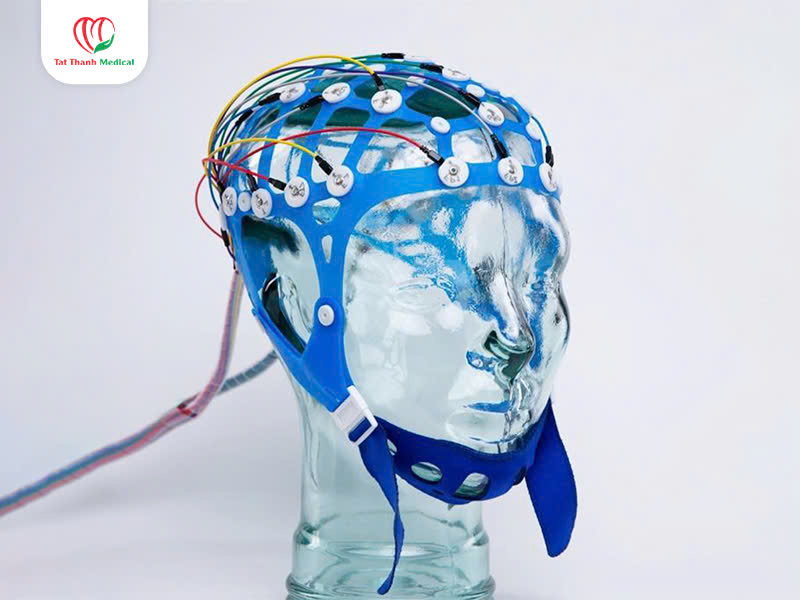 điện cực của máy điện nào