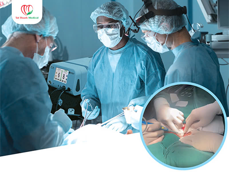 Dao mổ Plasma trong phòng mổ