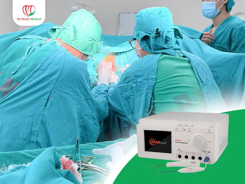 Viva RF System - Giải pháp hiện đại điều trị trĩ bằng sóng cao tần 