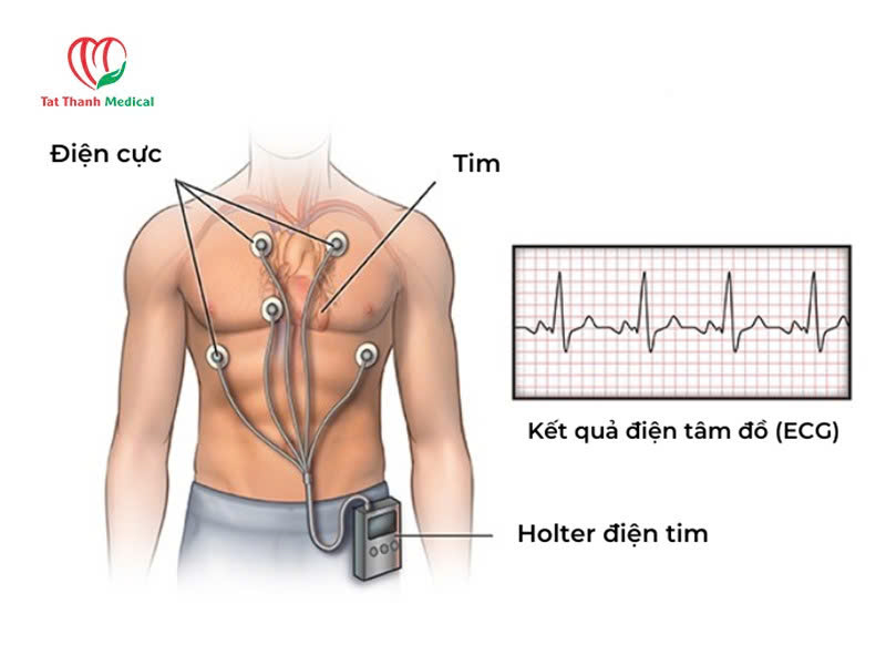 Đo điện tim