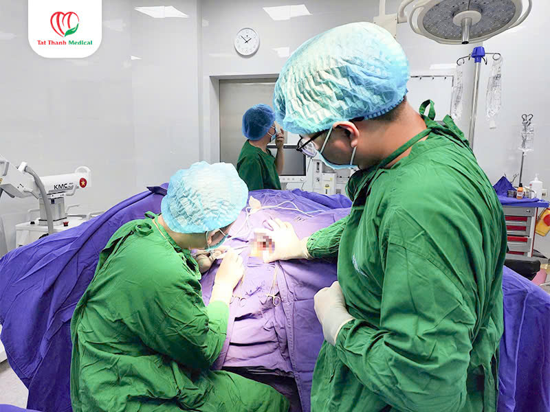 Điều trị trĩ bằng sóng cao tần RFA: Vì sao ngày càng được ưu tiên?