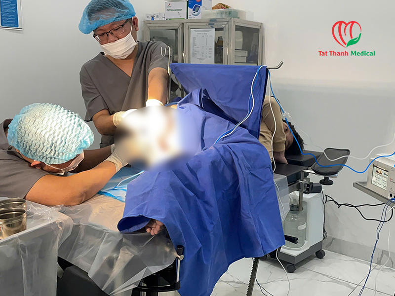 Điều trị trĩ bằng sóng cao tần RFA: Xu hướng mới trong ngoại khoa ít xâm lấn