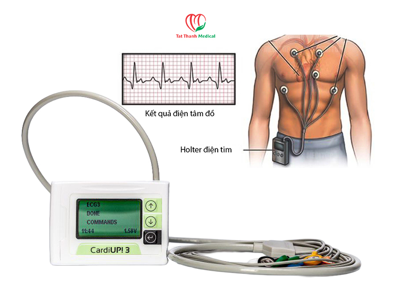 Máy Holter điện tim - Theo dõi nhịp tim liên tục
