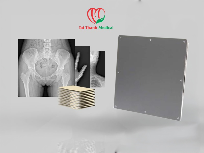 Tấm nhận ảnh X-quang DR - Xu hướng thay thế CR trong các cơ sở y tế hiện đại