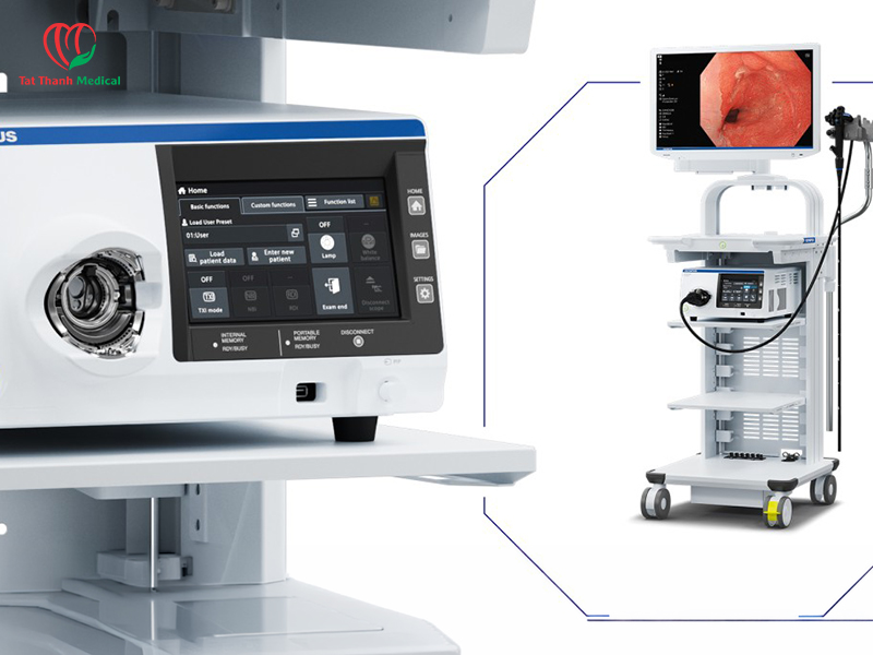 Hệ thống nội soi tiêu hóa - không chỉ là một thiết bị