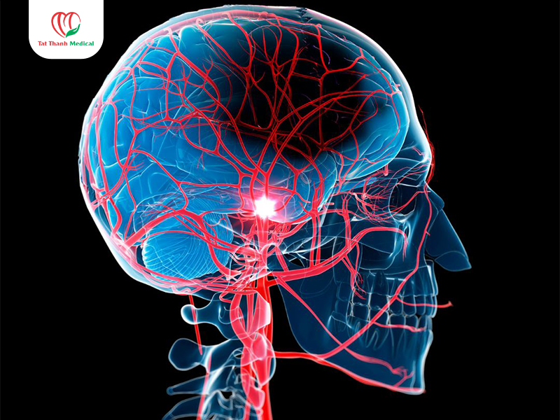 Máy lưu huyết não - công cụ đánh giá chức năng tuần hoàn não
