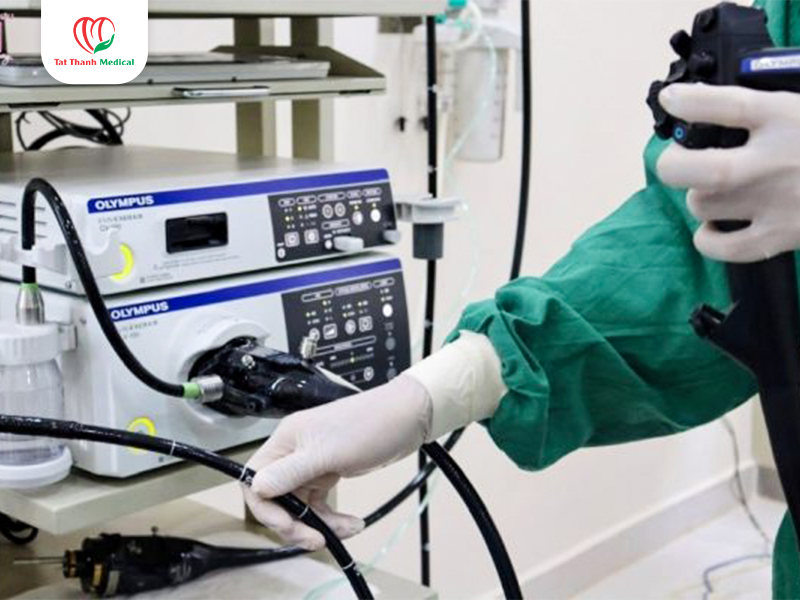Vai trò của nội soi tiêu hóa trong y học hiện đại