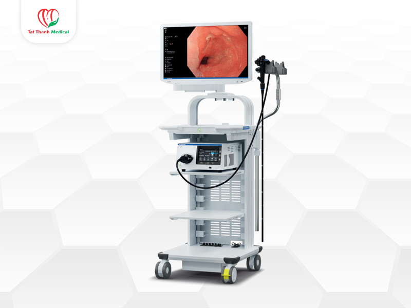 Vai trò của nội soi tiêu hóa trong chẩn đoán và điều trị