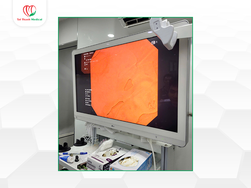 Hình ảnh độ phân giải cao và độ tương phản vượt trội