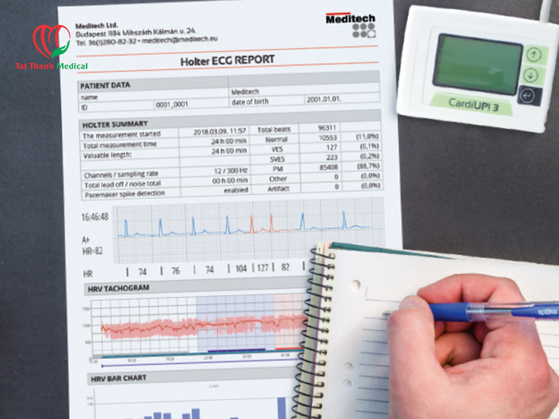 Vai trò của máy Holter điện tim 24h trong chẩn đoán tim mạch