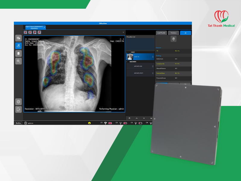 Tấm nhận ảnh X-quang DR: 5 tiêu chí lựa chọn cho bệnh viện đa khoa