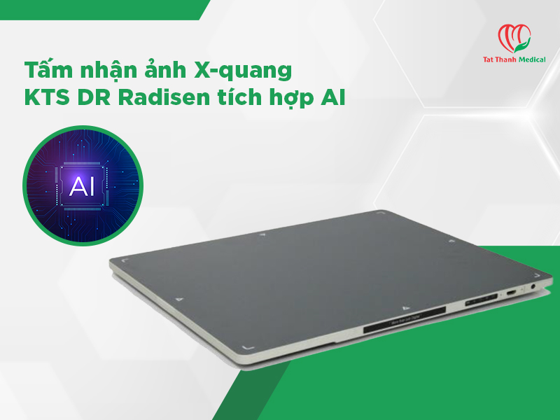 Tấm nhận ảnh X-quang DR: 5 tiêu chí lựa chọn cho bệnh viện đa khoa