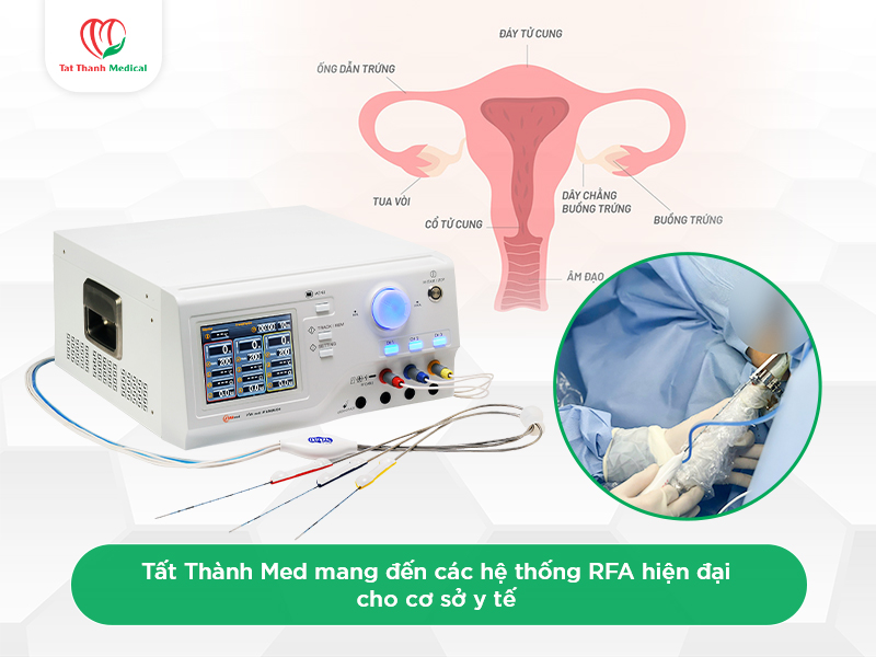 So sánh RFA và HIFU trong điều trị u xơ tử cung