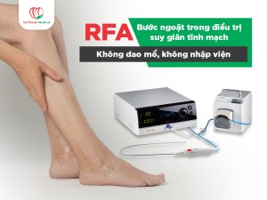 RFA - BÆ°á»›c ngoáº·t trong Ä‘iá»u trá»‹ suy giÃ£n tÄ©nh máº¡ch: KhÃ´ng dao má»•, khÃ´ng nháº­p viá»‡n