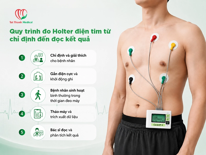 Máy Holter điện tim CardiUp!3