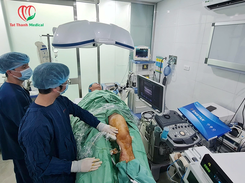 RFA phối hợp foam sclerotherapy
