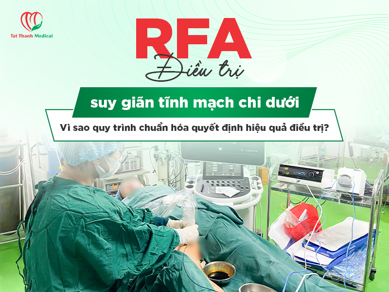 RFA điều trị suy giãn tĩnh mạch chi dưới: Vì sao quy trình chuẩn hóa giúp nâng cao hiệu quả điều trị?