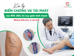 Xử lý biến chứng và tái phát sau RFA điều trị suy giãn tĩnh mạch: Những điều bác sĩ cần biết