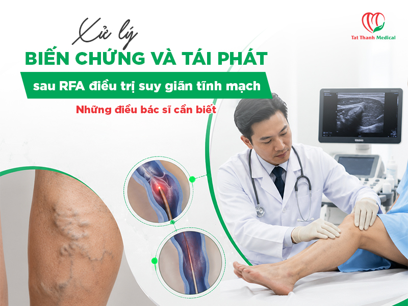 Xử lý biến chứng và tái phát sau RFA điều trị suy giãn tĩnh mạch: Những điều bác sĩ cần biết