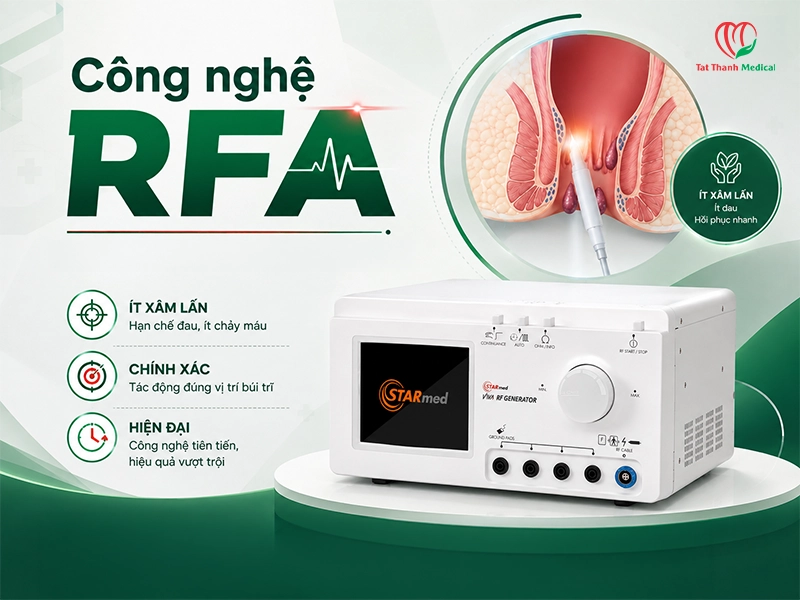 Điều trị trĩ bằng công nghệ RFA