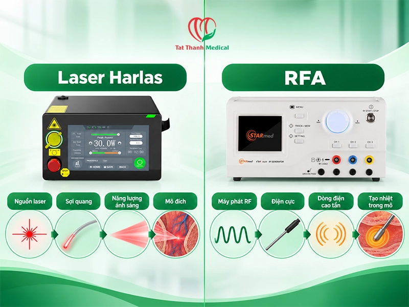 Điểm giống nhau giữa Laser Harlas và RFA