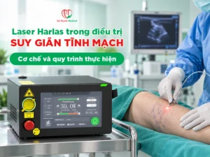 Laser Harlas trong điều trị suy giãn tĩnh mạch: Cơ chế và quy trình thực hiện