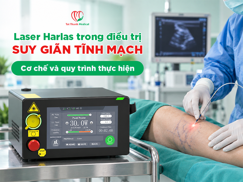 Laser Harlas trong điều trị suy giãn tĩnh mạch: Cơ chế và quy trình thực hiện
