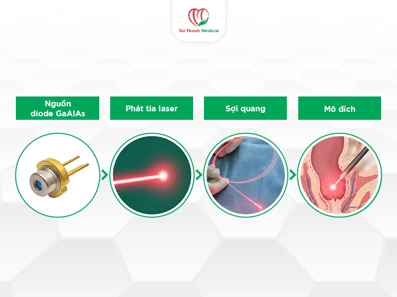 Laser diode GaAlAs là gì?