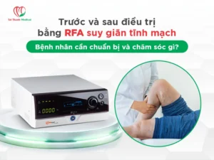 Trước và sau điều trị bằng RFA suy giãn tĩnh mạch: Bệnh nhân cần chuẩn bị và chăm sóc gì?