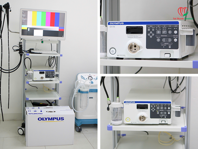 Olympus CV-170: Nhỏ gọn, tích hợp processor và nguồn sáng LED