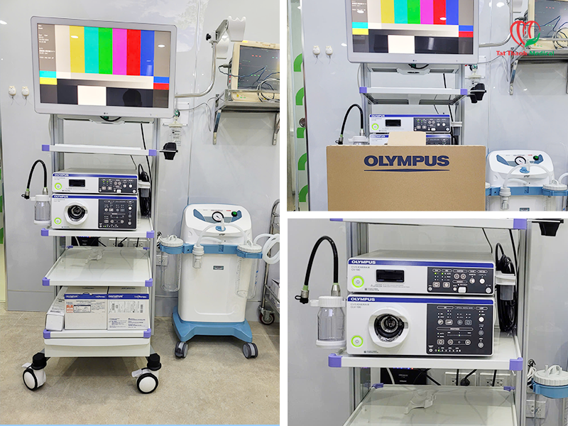 Olympus CV-190: Tập trung vào khả năng xử lý hình ảnh của EVIS EXERA III