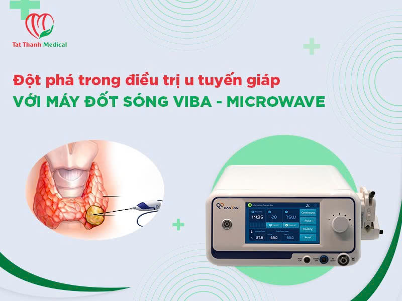 Đột phá trong điều trị u tuyến giáp với máy đốt sóng viba - Microwave