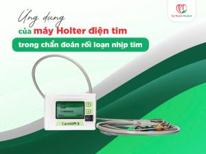 Ứng dụng của máy Holter điện tim trong chẩn đoán rối loạn nhịp tim