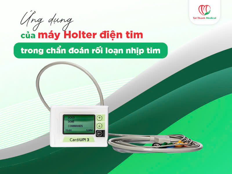 Ứng dụng của máy Holter điện tim trong chẩn đoán rối loạn nhịp tim