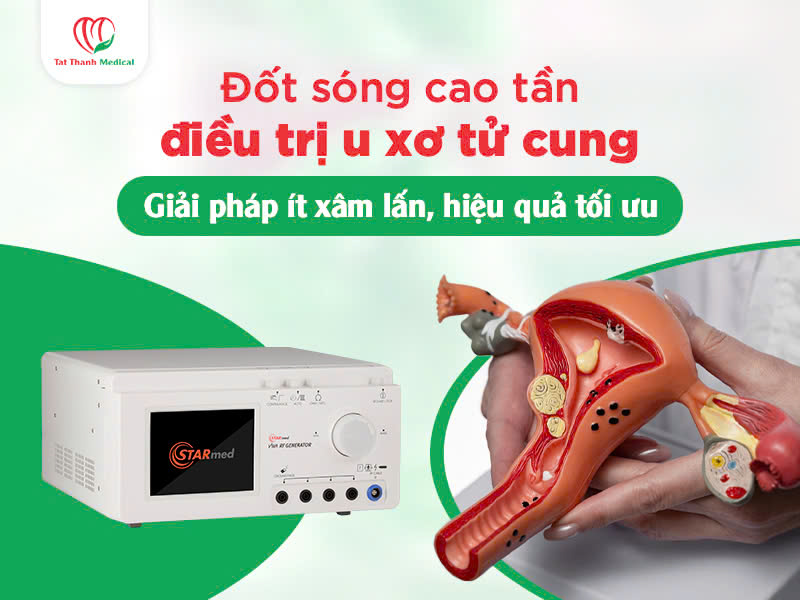 Đốt sóng cao tần điều trị u xơ tử cung: Giải pháp ít xâm lấn, hiệu quả tối ưu