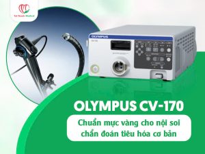 Olympus CV-170: Chuẩn mực vàng cho nội soi chẩn đoán tiêu hóa cơ bản