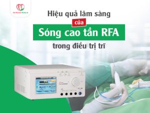 Điều trị trĩ bằng sóng cao tần